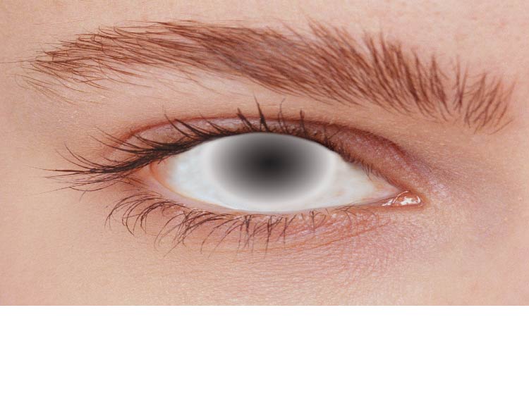 Damage Eye Lens